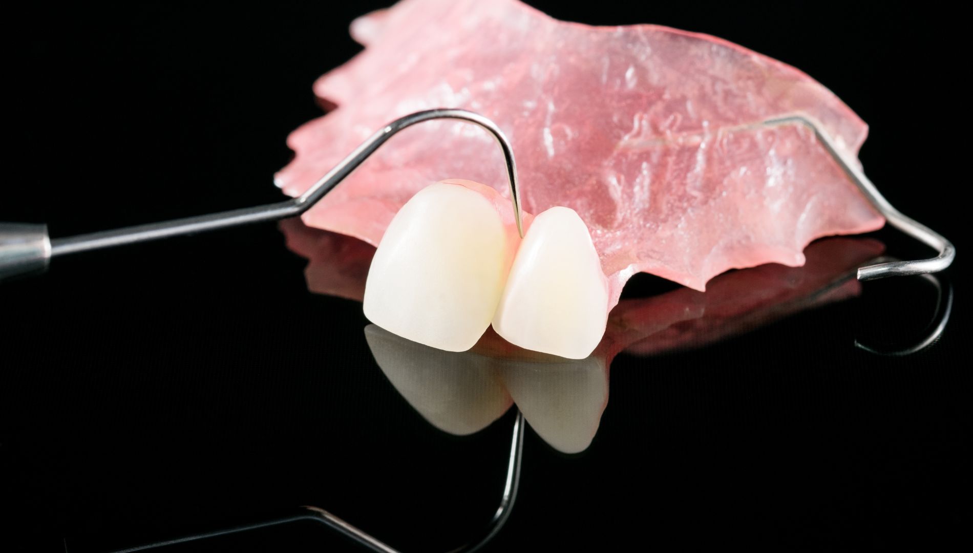 Akrilat vs. metalne baze – koja proteza je udobnija?